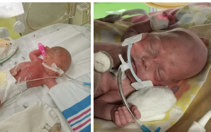 Noworodki w inkubatorze, podłączone do aparatury medycznej.