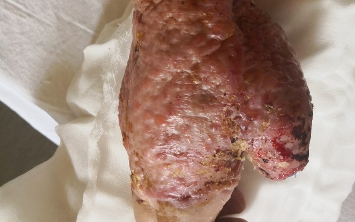 Zbiórka Operacja ręki prawej - zdjęcie główne