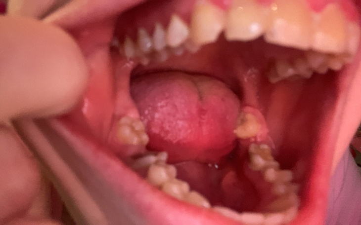 Dzieci bawiące się w wodzie na plaży.