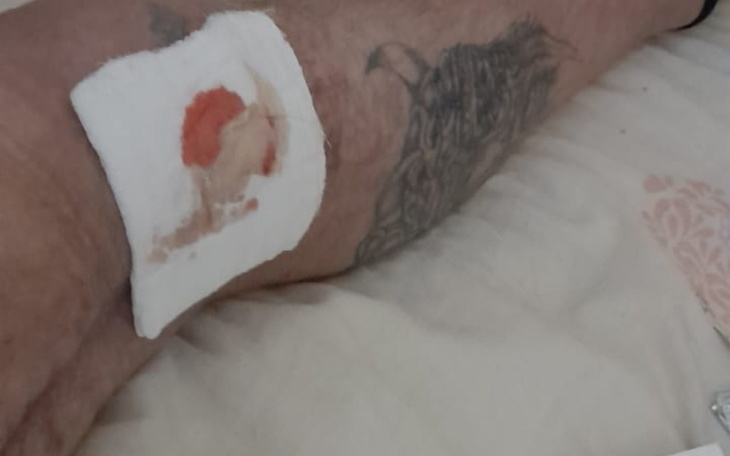 Zbiórka Opatrunki I leki - zdjęcie główne