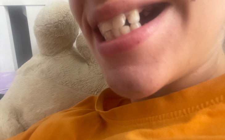 Zbiórka Na lepsze szczęście - zdjęcie główne