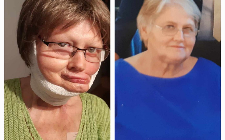 Zbiórka Operacja Benedykty - zdjęcie główne