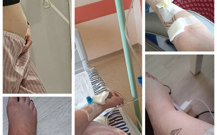 Kolaż zdjęć przedstawiających ręce z opatrunkami i tatuażami.