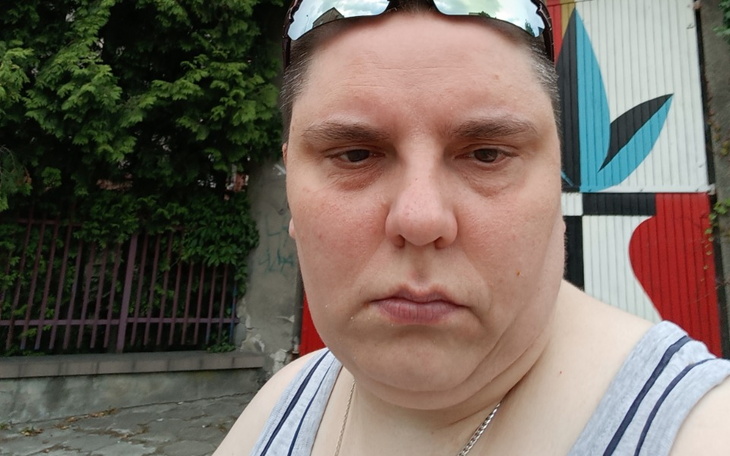 Zbiórka Zbieram na Operację Tetniaka - zdjęcie główne