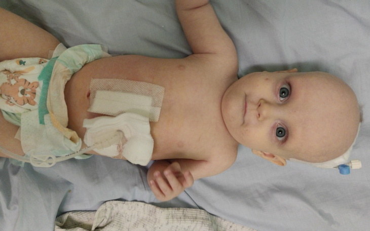 Zbiórka Dieta/specjaliści/rehabilitacje - zdjęcie główne