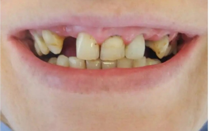 Zbiórka Leczenie zębów, normalne życie - zdjęcie główne