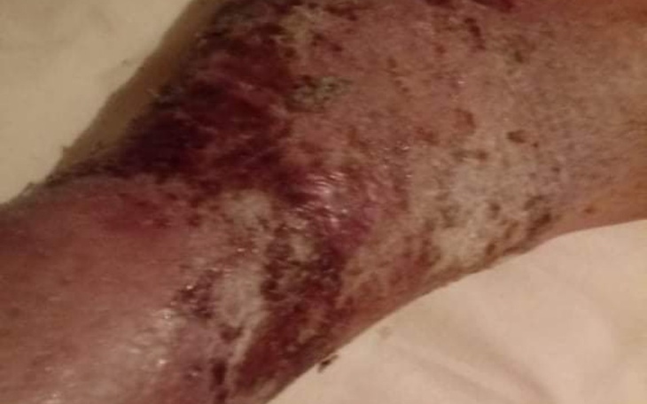 Zbiórka Na dług za mieszkanie i leki i j - zdjęcie główne