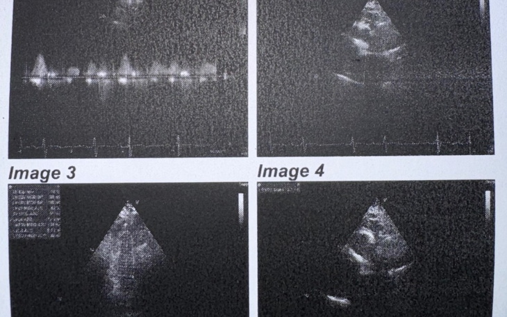 Zbiórka Zbiórka dla taty na leczenie - zdjęcie główne