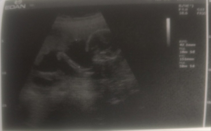 Zbiórka By normalnie zacząć żyć - zdjęcie główne