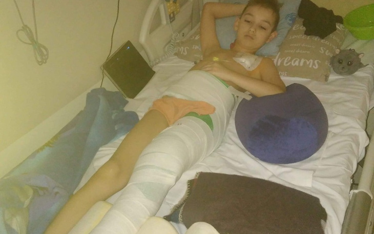 Chłopiec leży w łóżku szpitalnym, z opatrunkami na nogach.