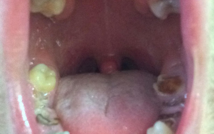 Zbiórka Pomóżcie mi wkoncu zacząć zyc... - zdjęcie główne