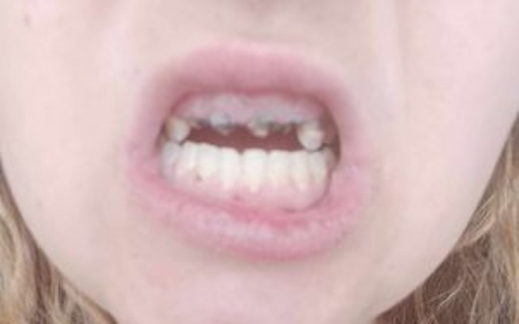 Zbiórka Nowy Uśmiech Dla Edyty - zdjęcie główne