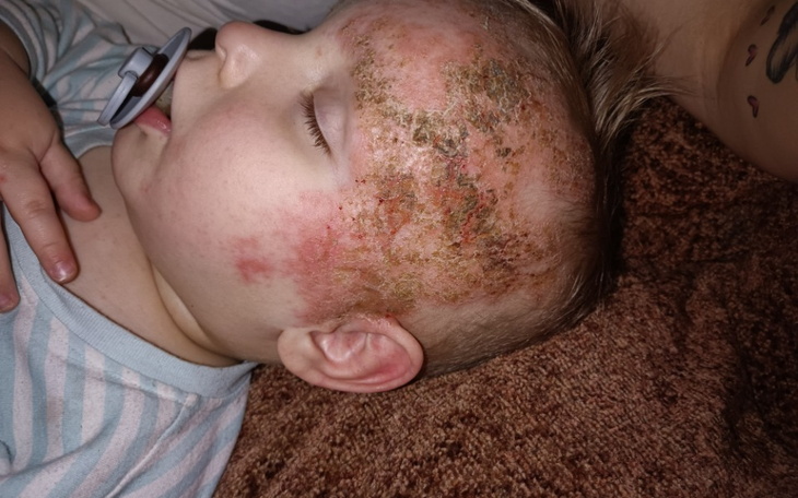 Zbiórka Skóra utkna z bólu i cierpienia - zdjęcie główne