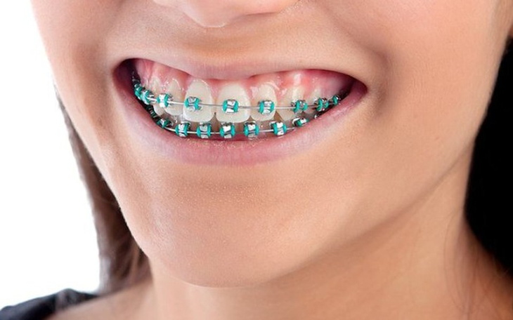 Zbiórka Naprawa zebów - zdjęcie główne