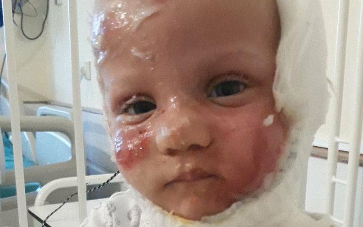 Zbiórka Pomoc dla Dorotki - zdjęcie główne