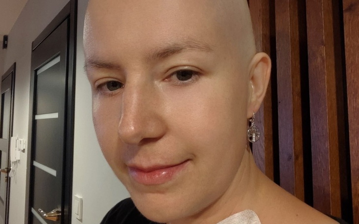 Młoda kobieta z łysą głową, uśmiechająca się do kamery.