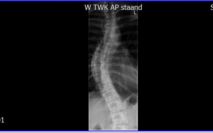 Zbiórka Rehabilitacja i budowa domu. - zdjęcie główne