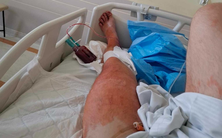 Zbiórka Cel zbiórki na rehabilitację - zdjęcie główne