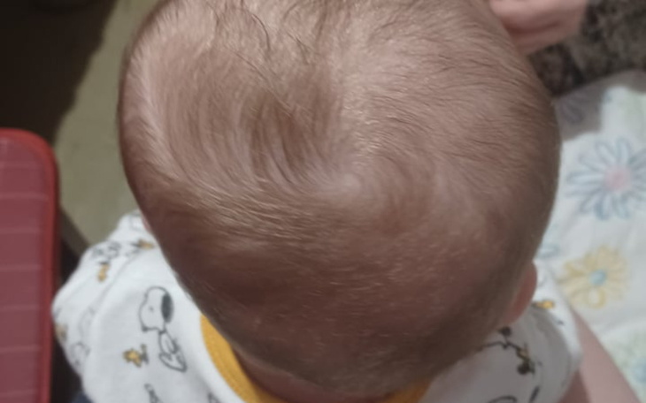 Widok na główkę niemowlęcia z charakterystycznym kształtem włosów.