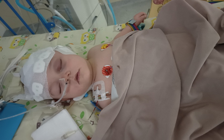 Małe dziecko w szpitalu z monitorami medycznymi.