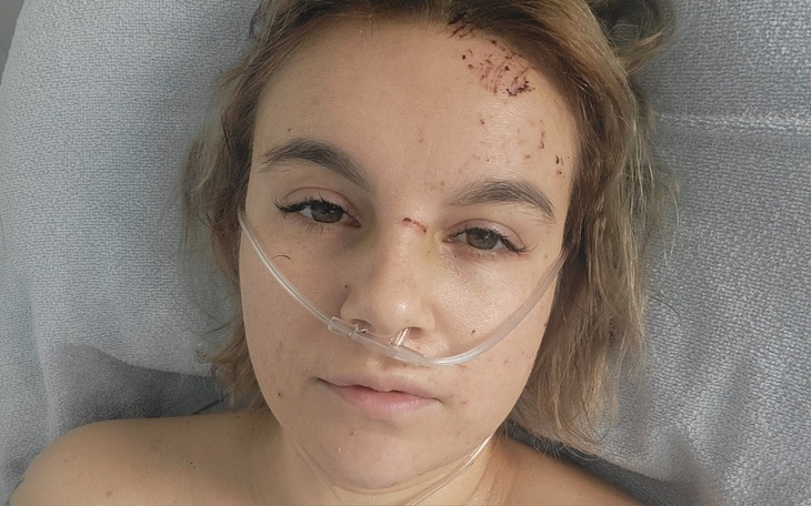 Młoda kobieta w szpitalu, z tlenem na twarzy.