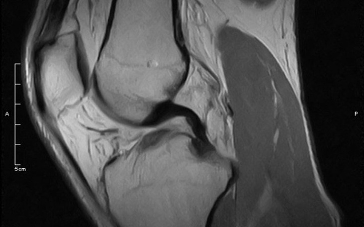 Zbiórka kolano za gitary - zdjęcie główne