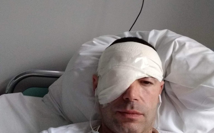 Zbiórka Na protezę oka .. - zdjęcie główne