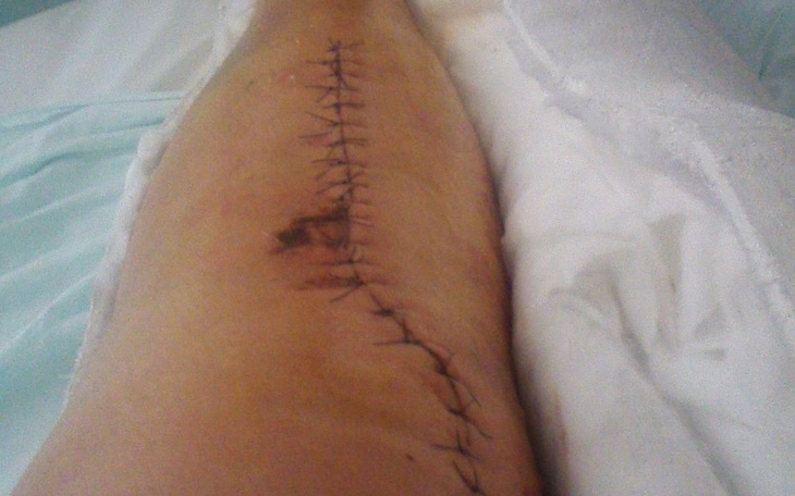 Zbiórka Poprawa sprawności ruchowej - zdjęcie główne