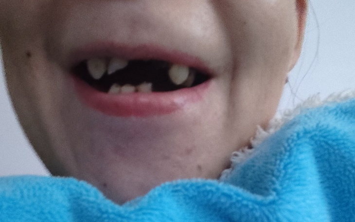 Zbiórka Upragniony Uśmiech - zdjęcie główne