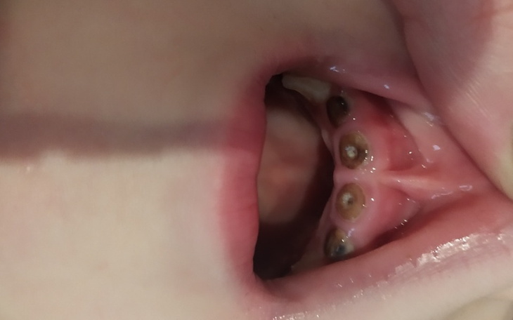 Zbiórka Na ząbki mojego syna - zdjęcie główne