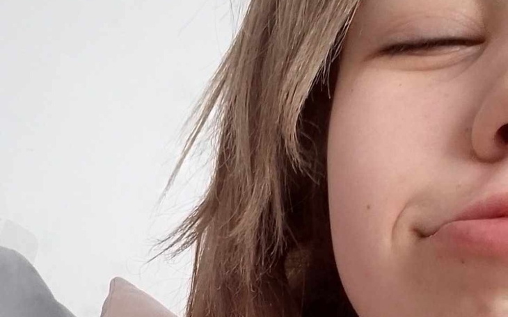 Zbiórka aparat na zęby dla Amelki - zdjęcie główne