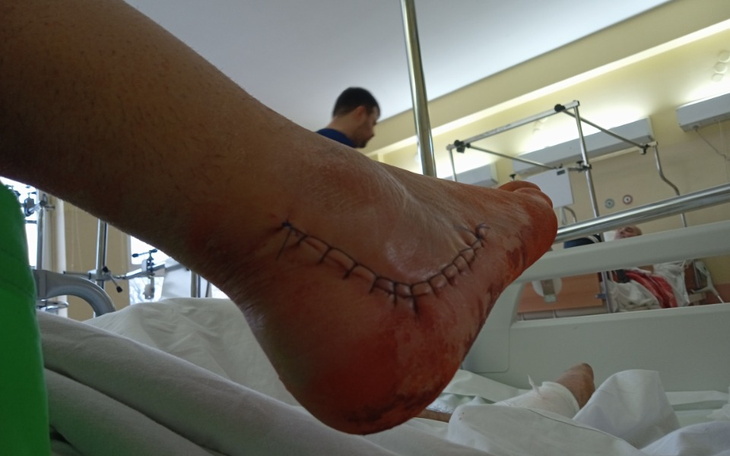 Zbiórka Na dalsze leczenie i mieszkanie - zdjęcie główne