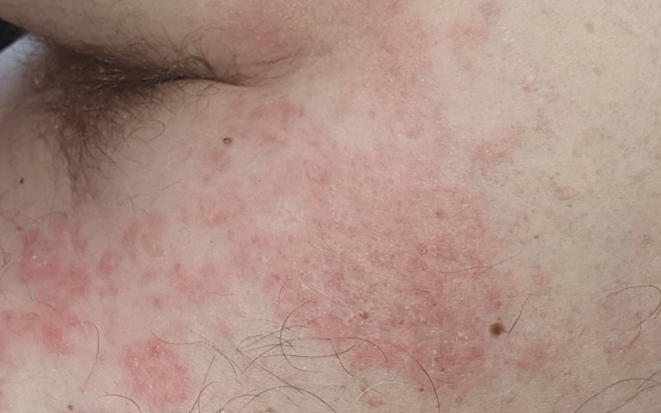 Zbiórka Chciałbym wrócić do normlności. - zdjęcie główne