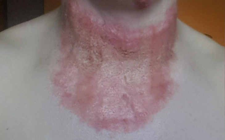 Zbiórka Na usunięcie blizn Dla Dominika - zdjęcie główne