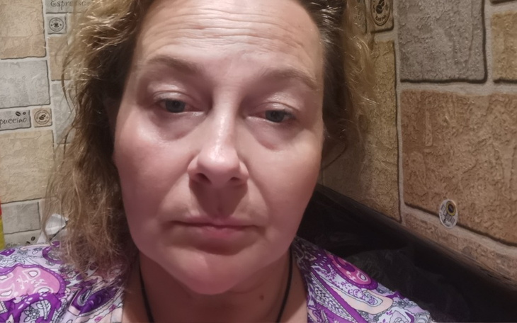 Zbiórka Wsparcie po pożarze samochodu - zdjęcie główne