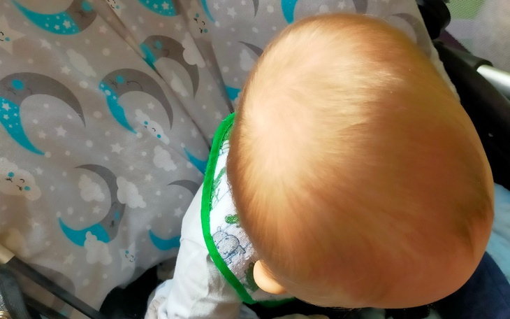 Zbiórka Kask korekcyjny dla Jasia - zdjęcie główne