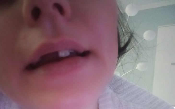 Zbiórka Na wymarzony piękny uśmiech - zdjęcie główne