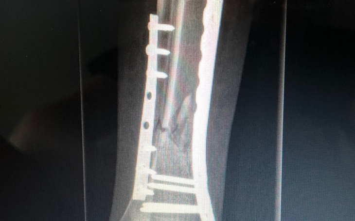 Zbiórka Leczenie exogenem - zdjęcie główne