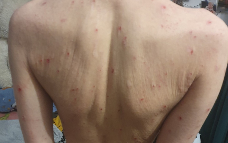 Zbiórka Kochane biedactwo - zdjęcie główne