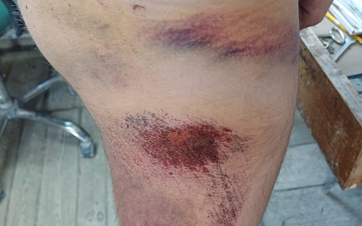 Zbiórka Naprawa motocykla po szlifie - zdjęcie główne