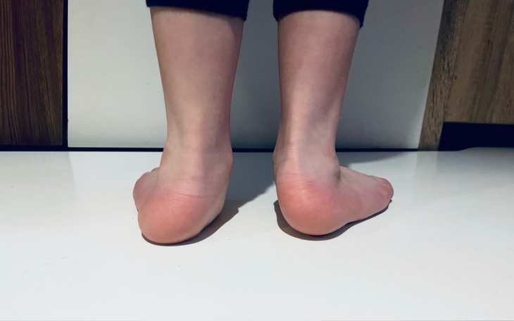 Stopy dziecka stojącego na podłodze.