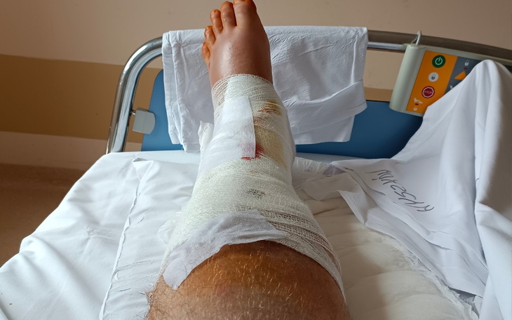 Zbiórka Rechabiltacja Nogi - zdjęcie główne