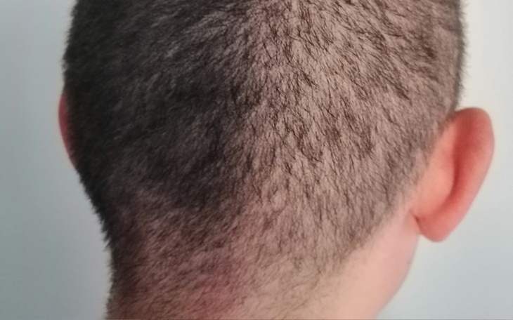 Zbiórka Walka o normalne życie bez dlugu - zdjęcie główne