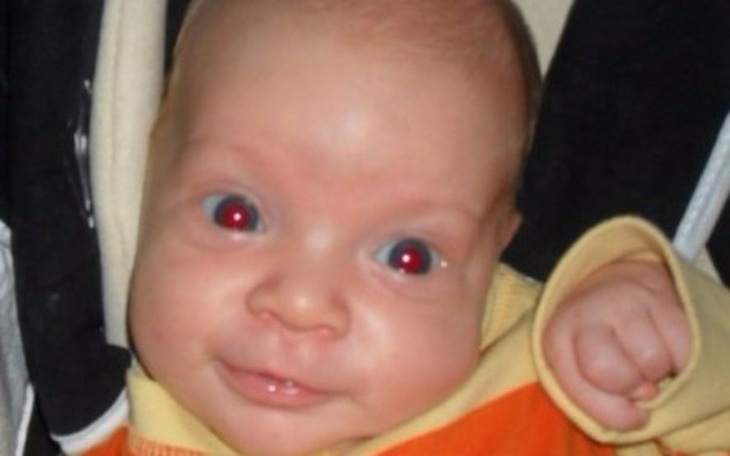 Zbiórka Zbiórka dla Amelki na lekarstwa - zdjęcie główne