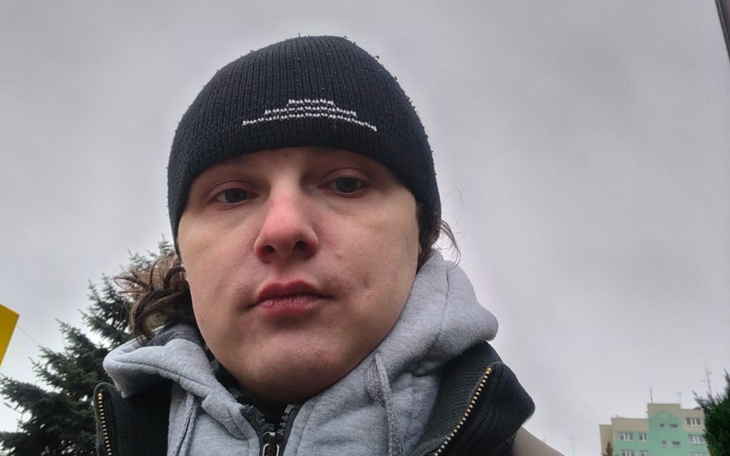 Zbiórka Diagnostyka, leczenie - zdjęcie główne