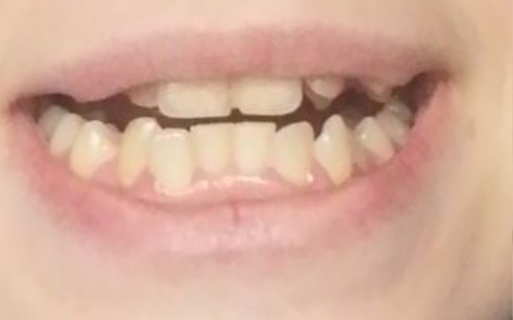 Zbiórka Marzenie o prostych zębach... - zdjęcie główne