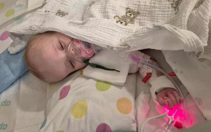 Małe dziecko w szpitalu z aparaturą medyczną.