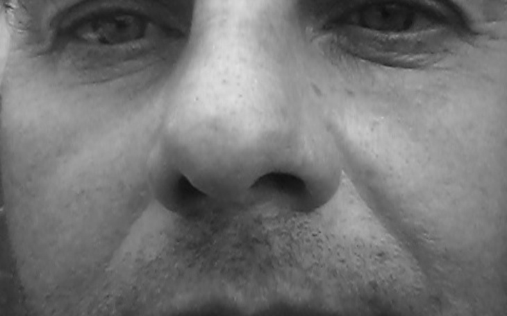 Zbiórka na lekarstwa i rehabilitacje - zdjęcie główne