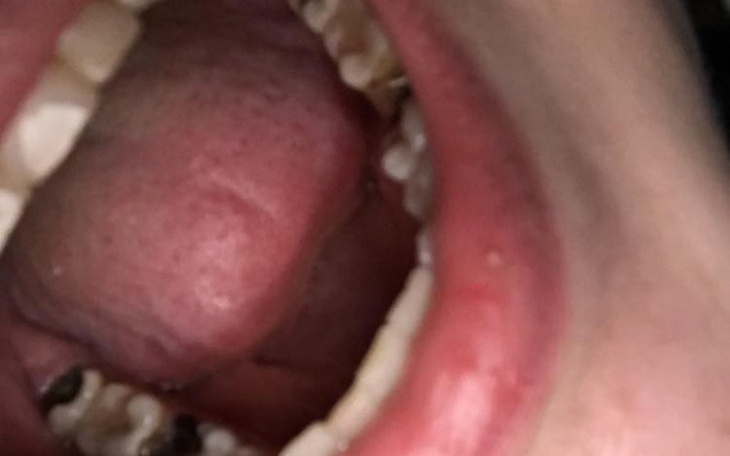 Zbiórka Piękne, nowe, zdrowe zęby - zdjęcie główne