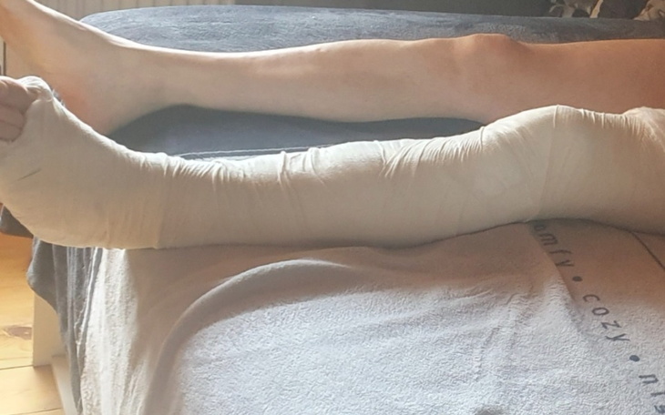 Zbiórka Operacja Więzadła ACL ALL - zdjęcie główne